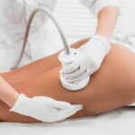 Ultrasonic Liposuction Pros and Cons